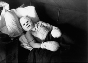 Lee Miller - "Quemaduras graves. Normandía" (1944) - La imagen muestra un plano general picado de un soldado sobre una cama con el rostro, el pecho, un brazo y ambas manos vendadas, que mira a la cámara. Los huecos del vendaje para sus ojos, nariz y boca le dan un aspecto casi tierno, como si estuviera sonriendo. Pulse para ampliar.